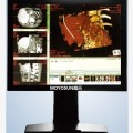 X光机医用显示器