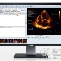 四维彩超B超/超声工作站软件
