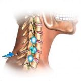 治疗颈肩腰腿疼痛到哪里？就到省工疗疼痛科